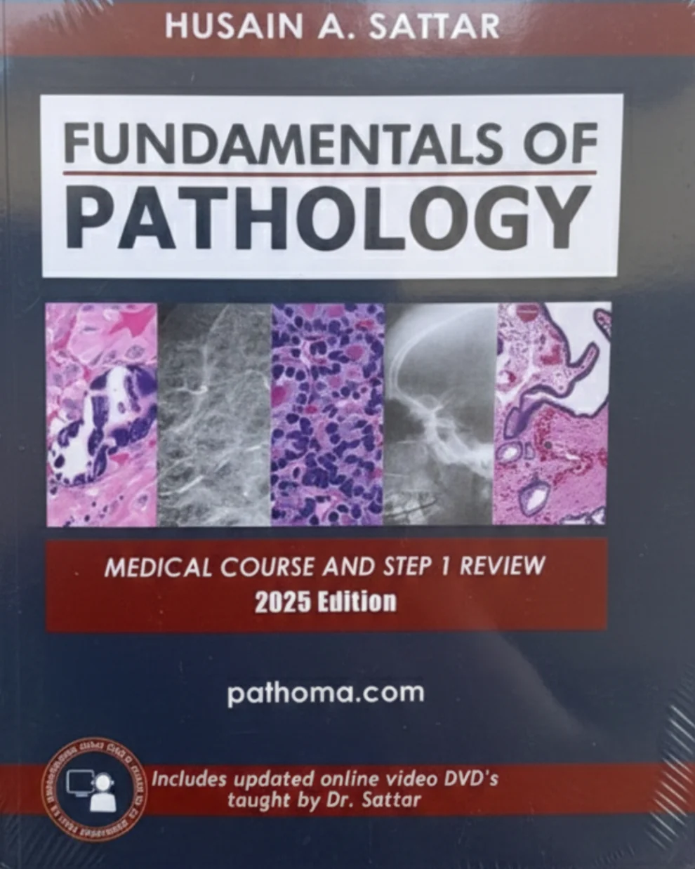 Fundamentals of Pathology (Pathoma)